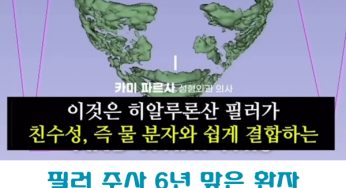 (성형외과) 히알루론산 필러 주사 6년 맞은 환자 MRI 그래픽 결과