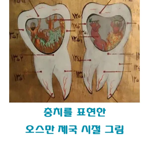 충치를 표현한 오스만 제국 시절 그림